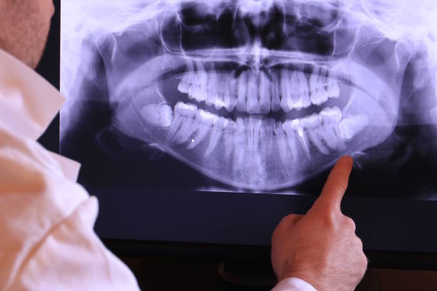 Best Urgent Tooth Repair  in Fairfax, OH